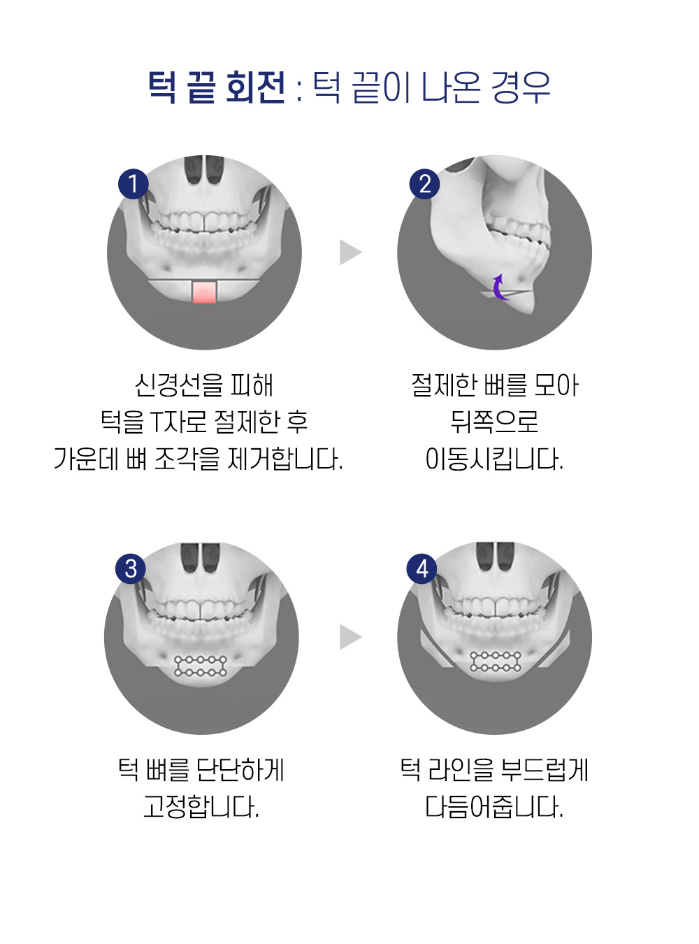 턱 끝 회전