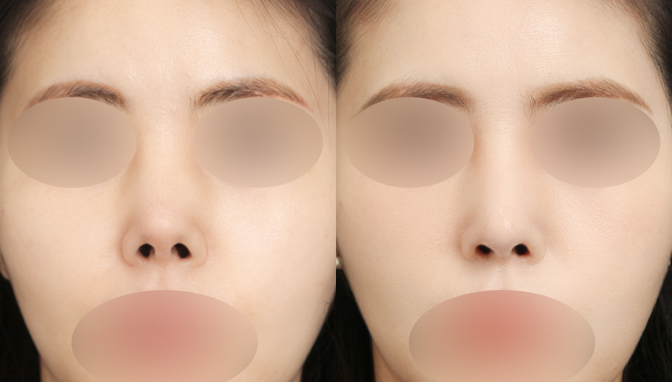 포토후기 이미지
