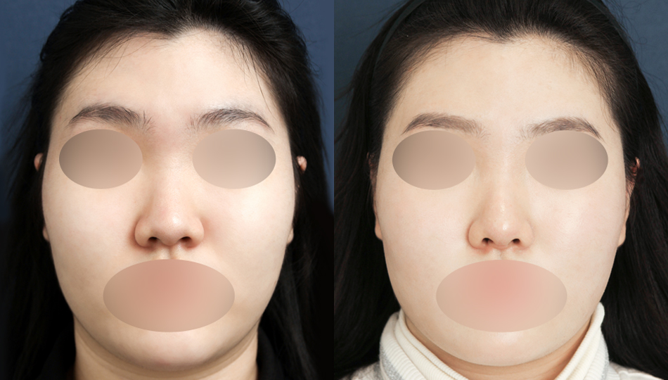 포토후기 이미지