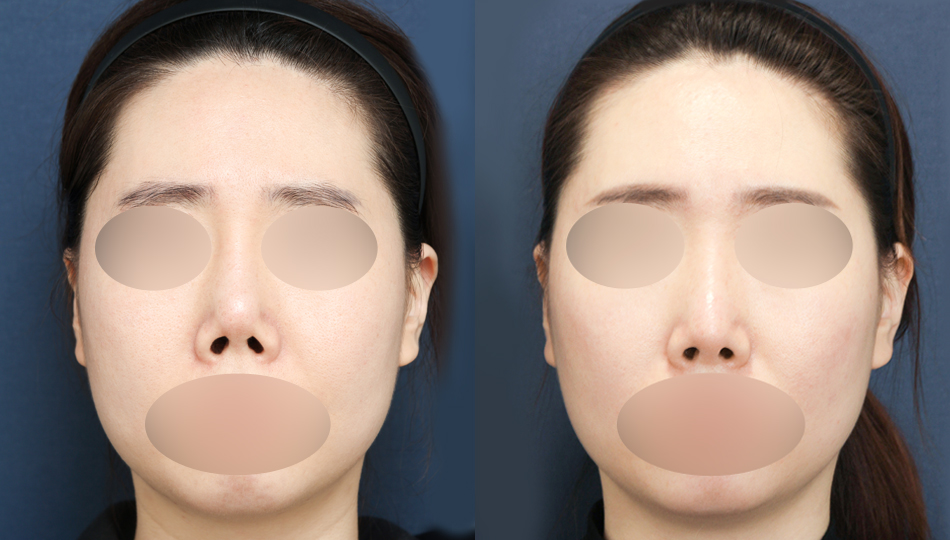 포토후기 이미지