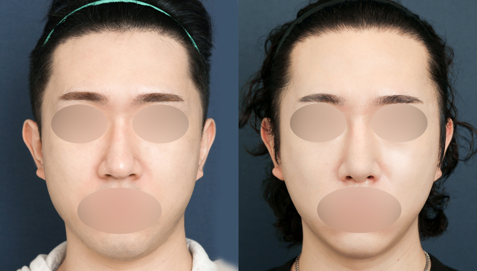 포토후기 이미지