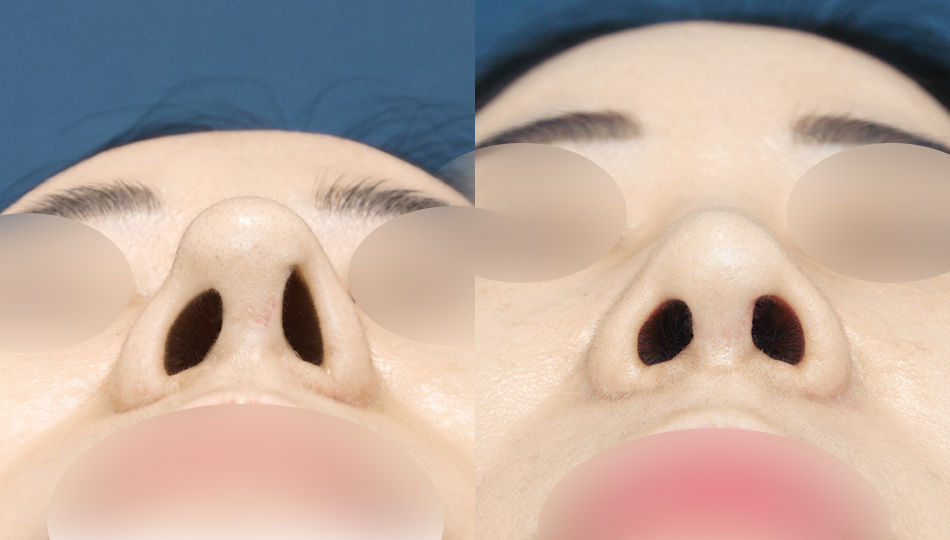 관련이미지