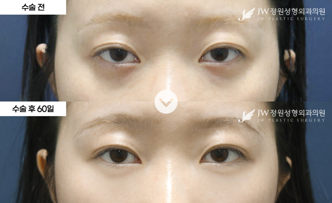 포토후기 이미지