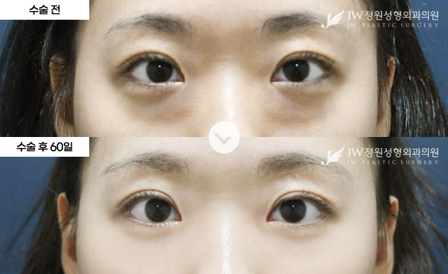 포토후기 이미지