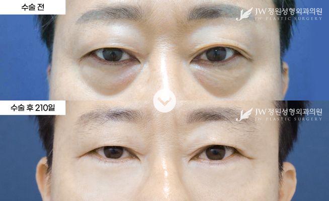 포토후기 이미지