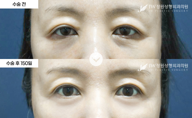 포토후기 이미지