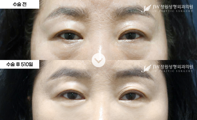 포토후기 이미지
